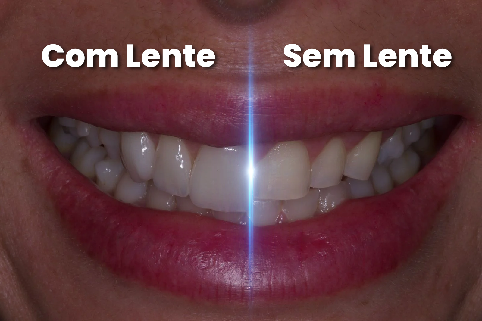 com lente sem lente